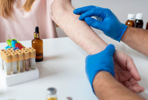 scabies treatment non prescription