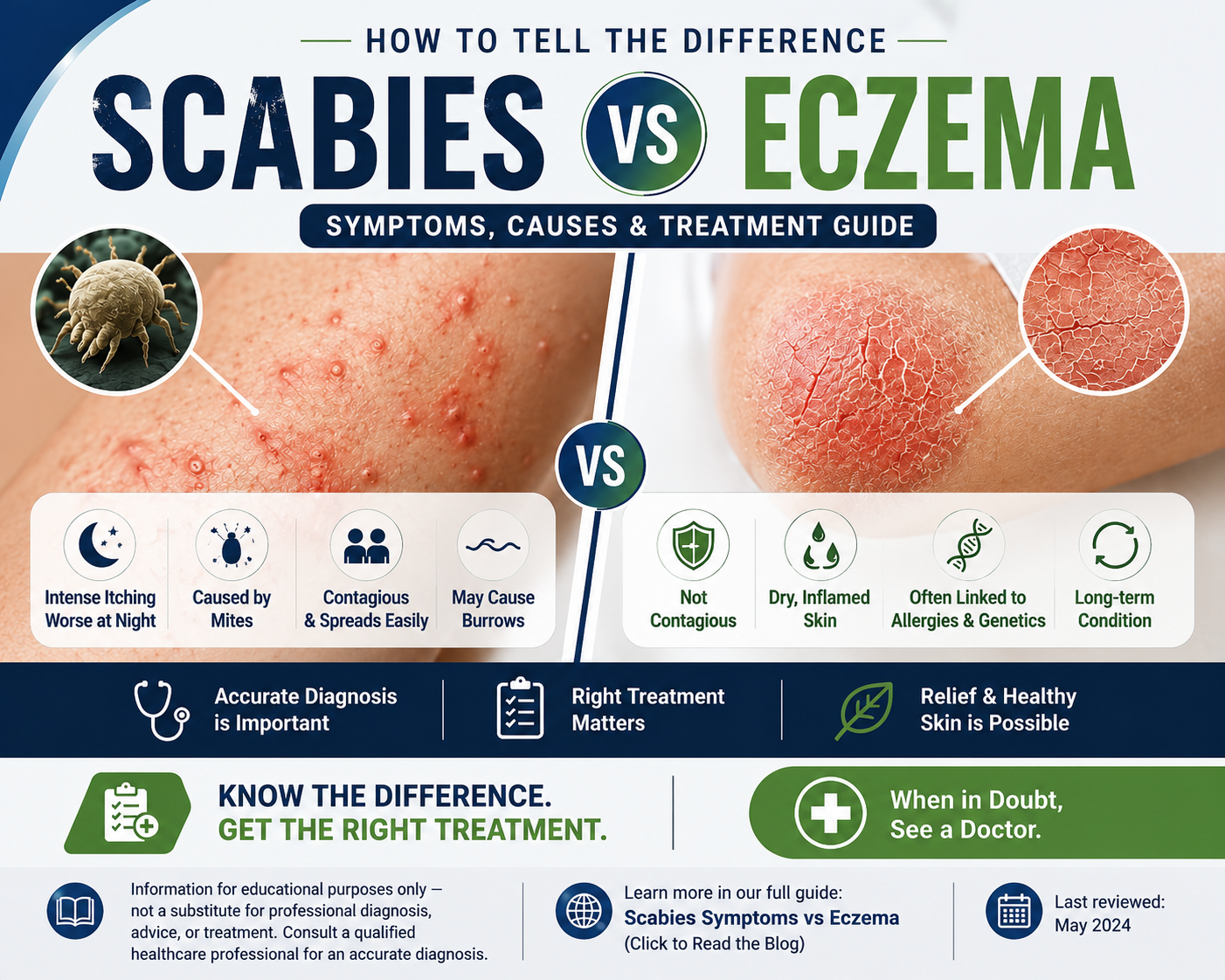 Scabies vs eczema