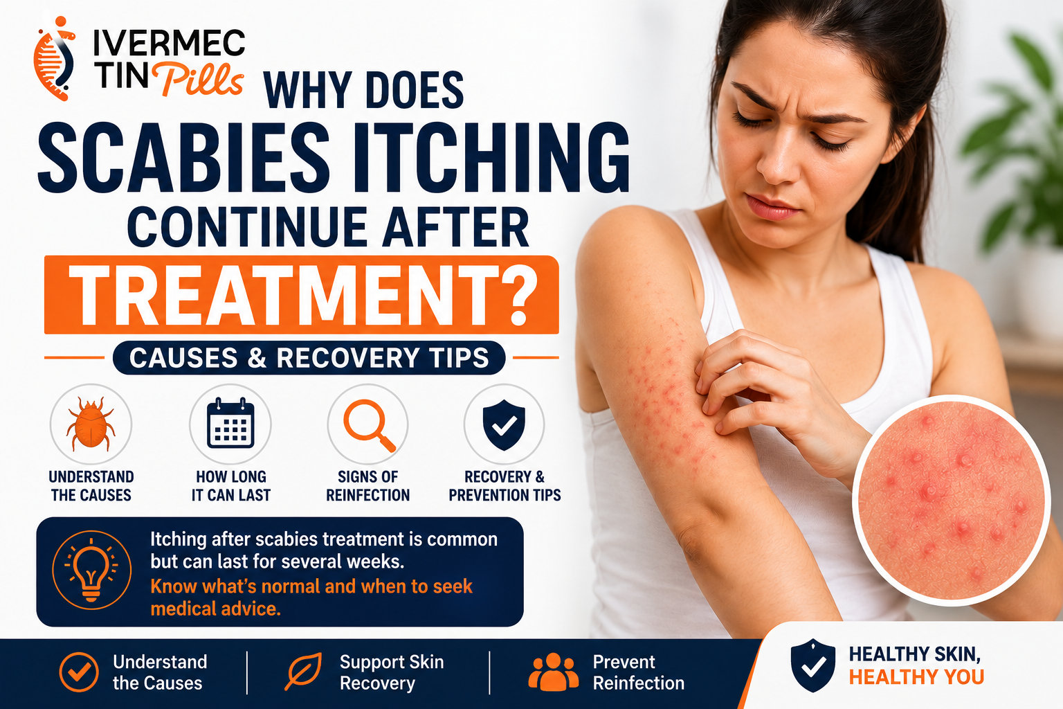 itching after scabies treatment